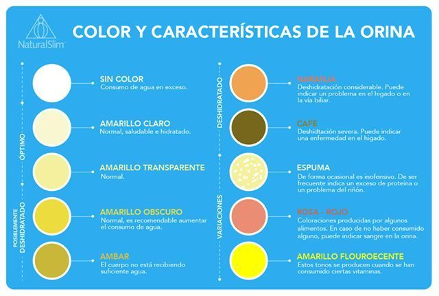 Infografía EXAMEN GENERAL DE ORINA | Genially